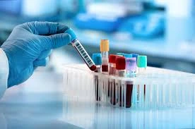 Laboratory Testing